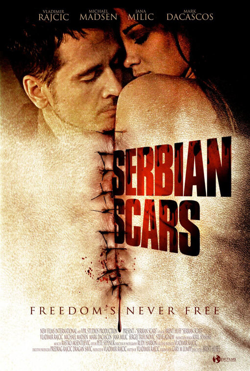 Serbian Scars