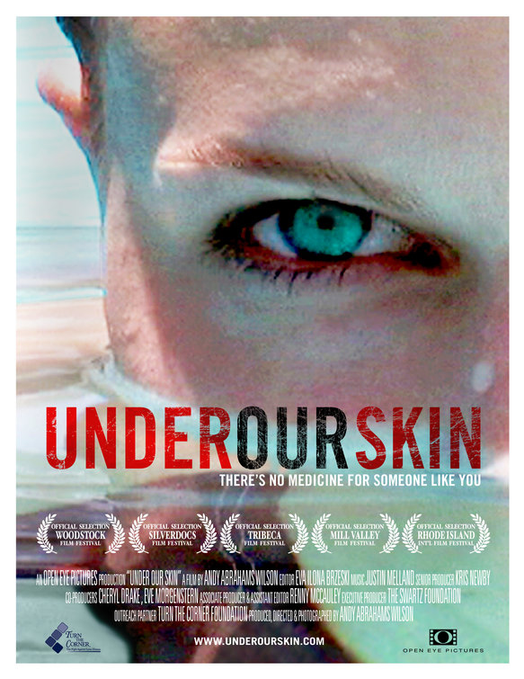 Under Our Skin